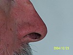 [A closeup of Bob's nose]